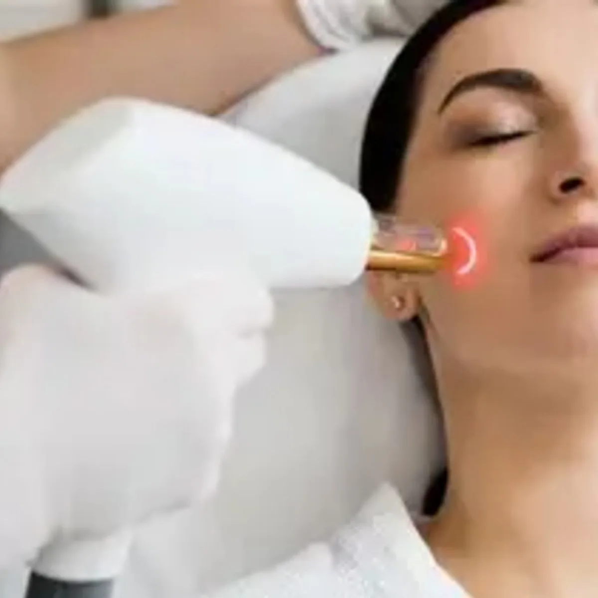 Before Chemical Peel